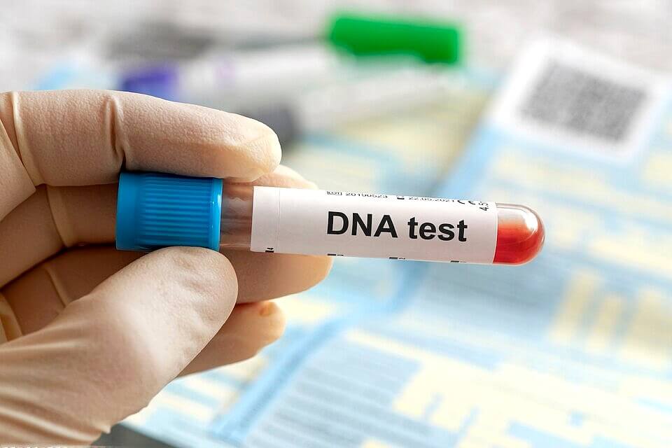 DNA-Testetikett